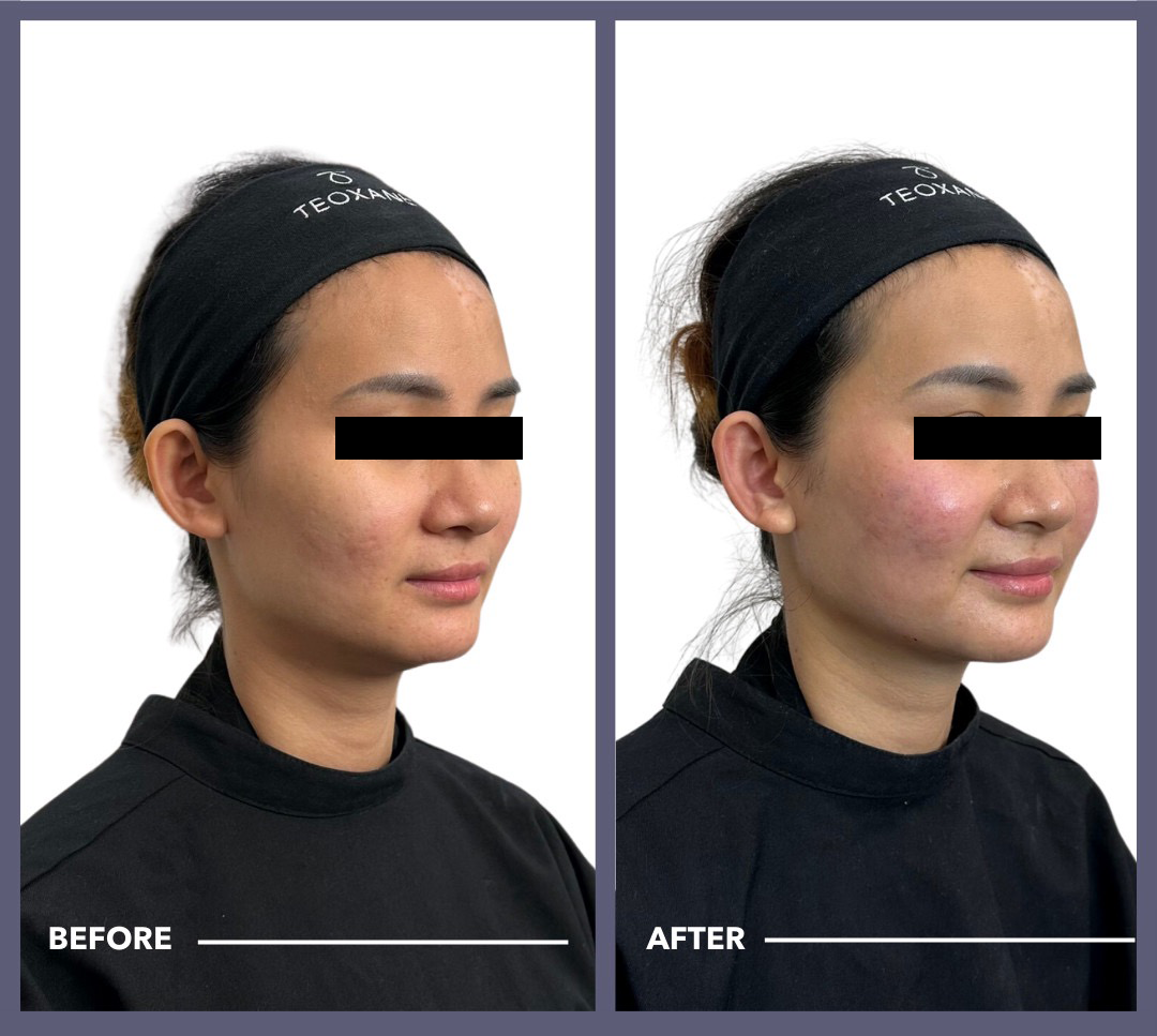 client